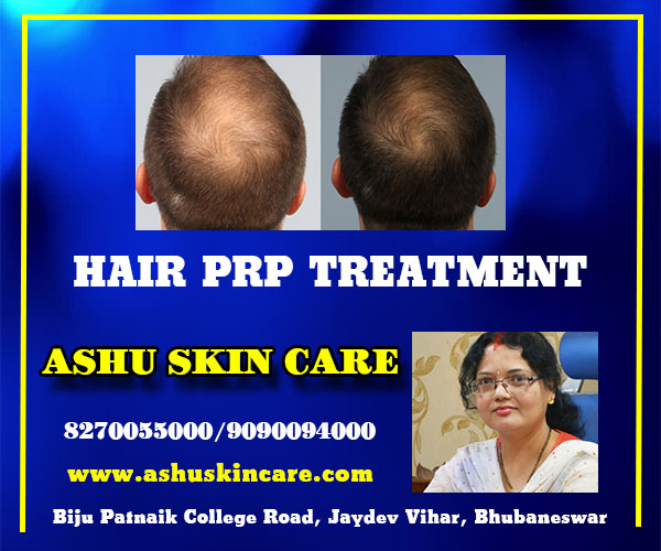 best hair prp treatment clinic in bhubaneswar near me - dr anita rath